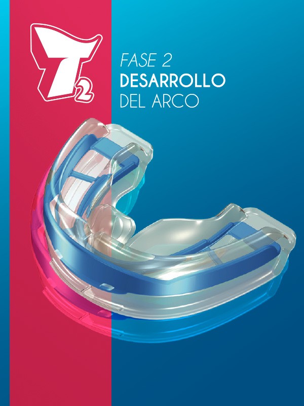 T2 MYOBRACE FOR TEENS MEDIUM CLEAR